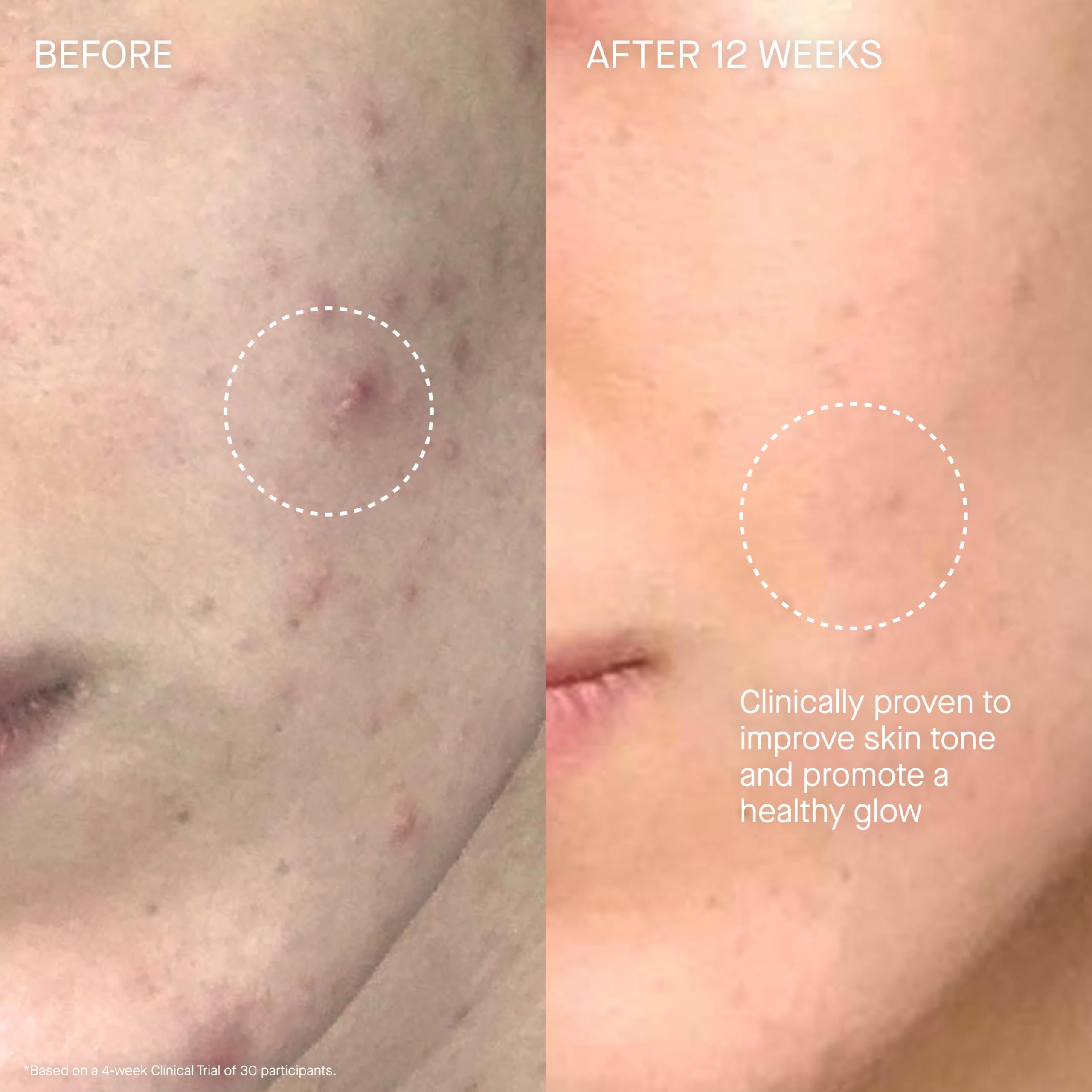 Augustinus Bader The Cream on face and décolleté supports daily hydration.