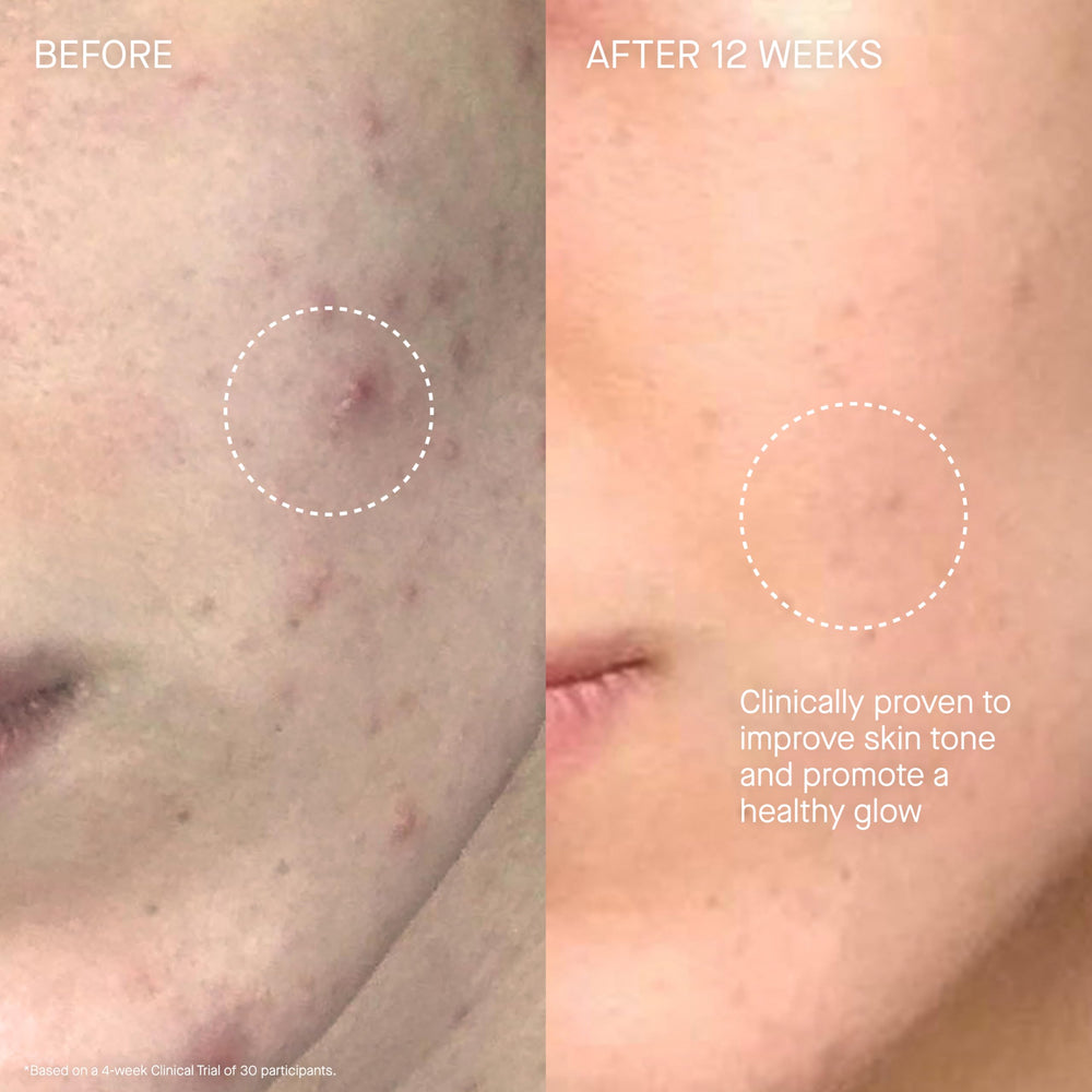 Augustinus Bader The Cream on face and décolleté supports daily hydration.