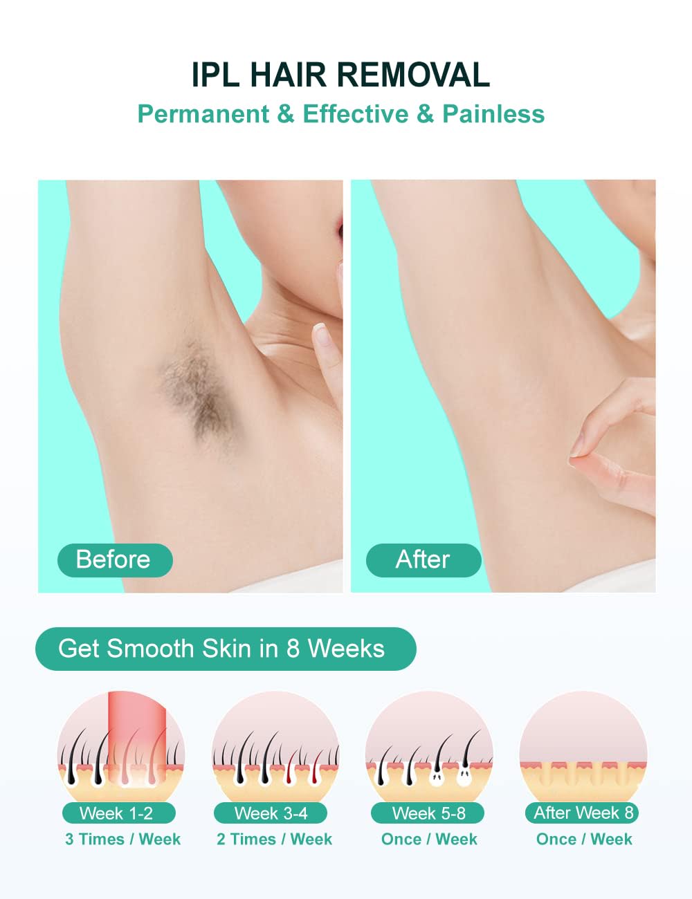 AUITRONCARE IPL hair removal manual mode for precise spot treatment.