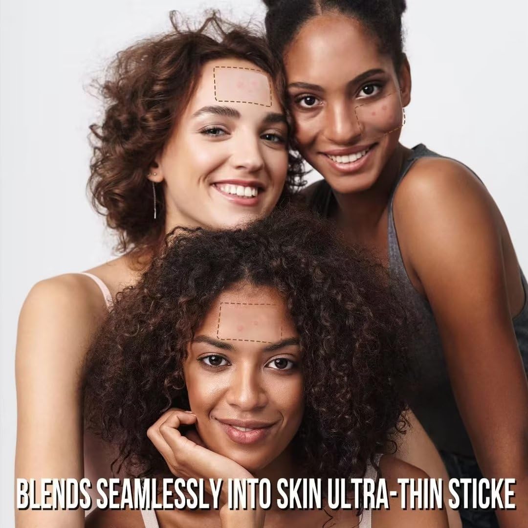 AUSLKA blemish patches in use on the cheek demonstrate discreet coverage and potential flatter appearance.