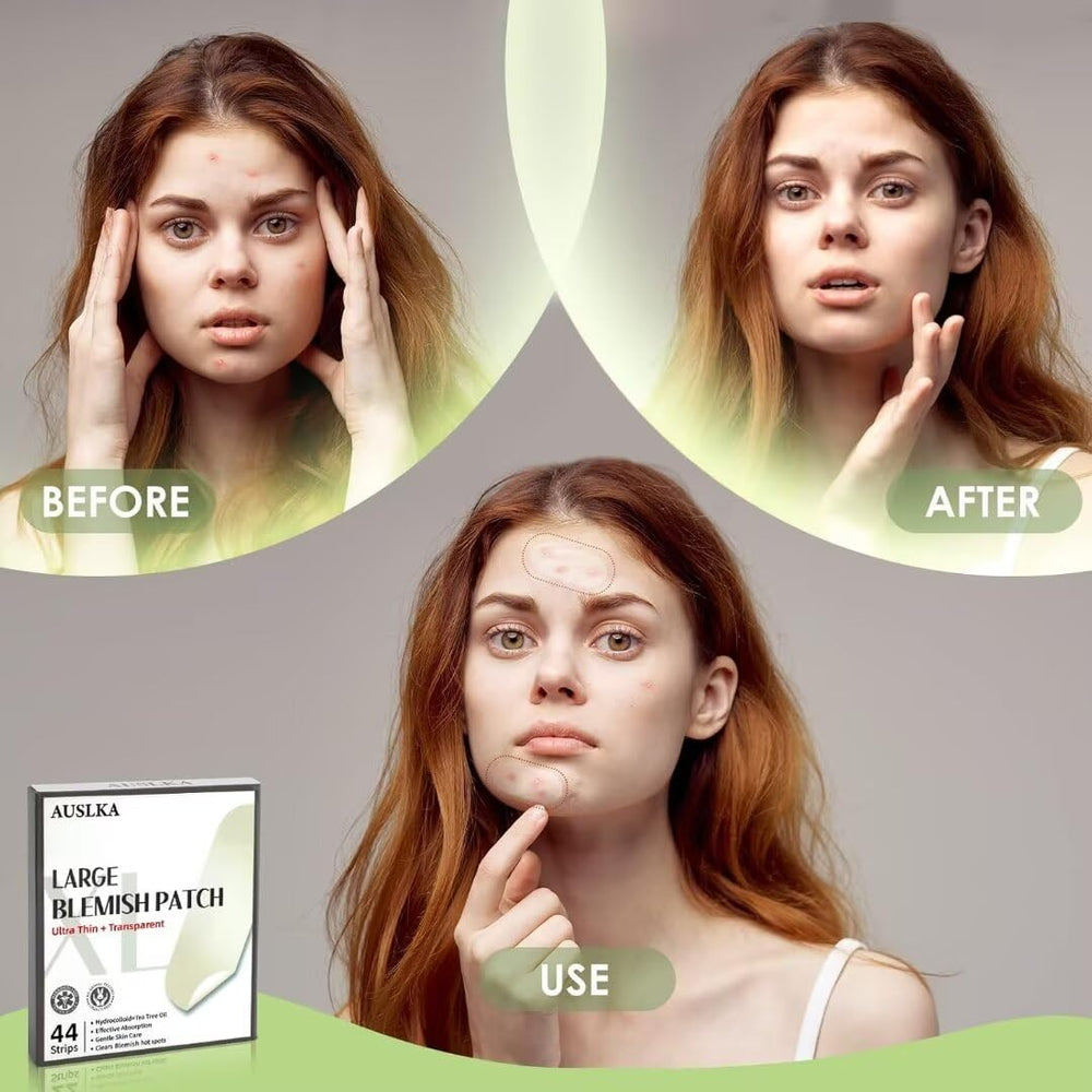 AUSLKA blemishes patches large-area back-neck-chest application highlights size upgrade.