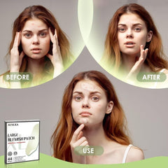 AUSLKA blemishes patches large-area back-neck-chest application highlights size upgrade.