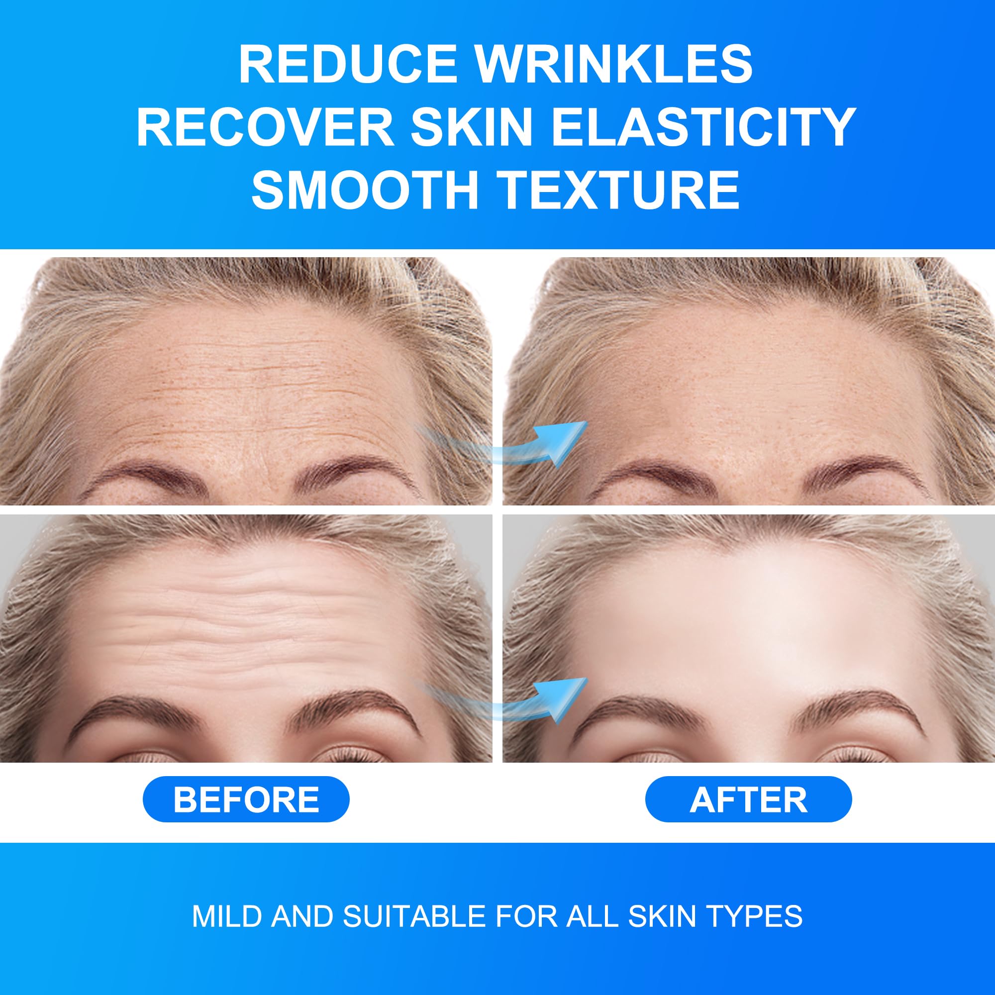 Auteek forehead wrinkle patches jelly texture provides comfortable wear and skin contact.