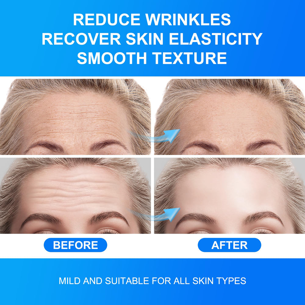 Auteek forehead wrinkle patches jelly texture provides comfortable wear and skin contact.
