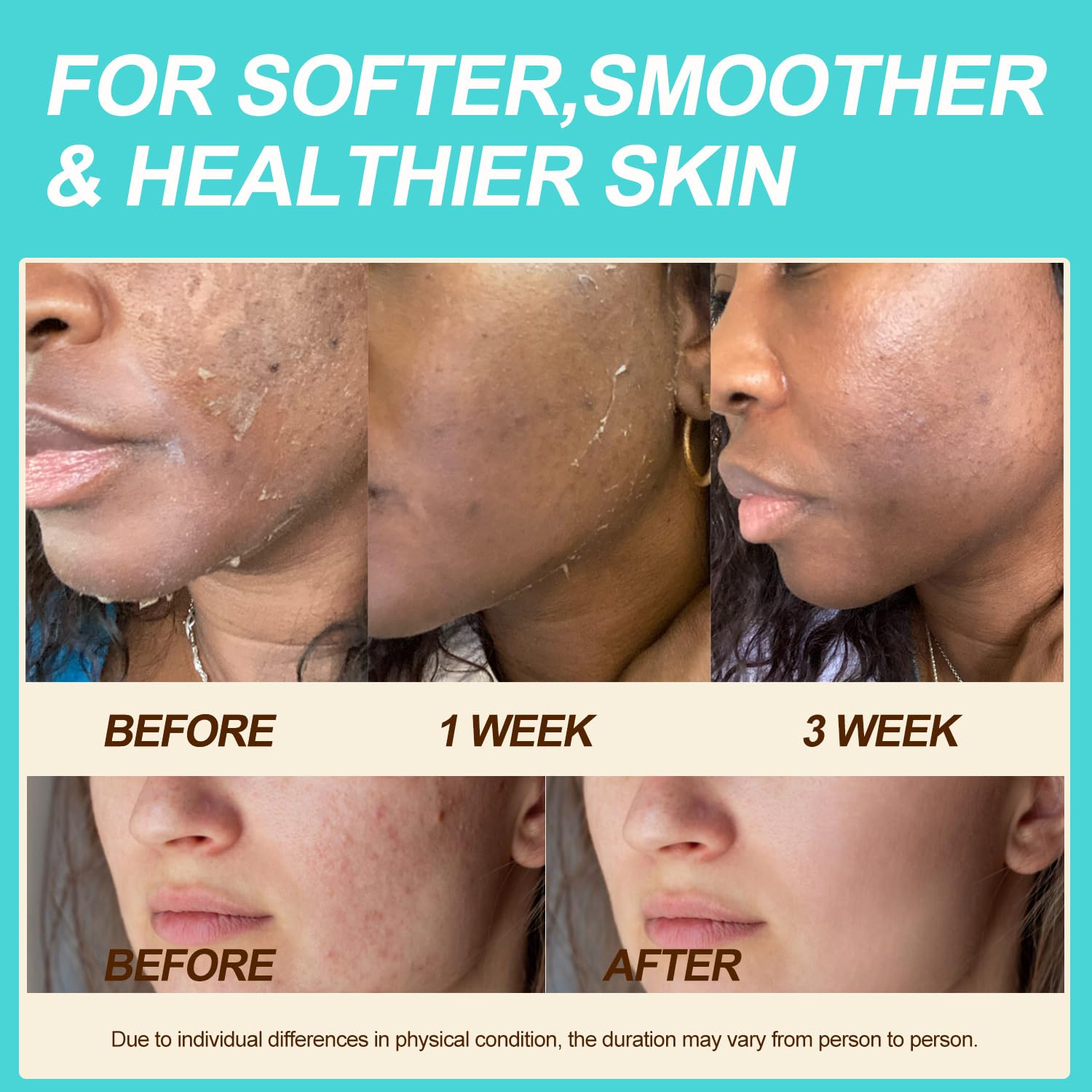 Auteli shea butter and jojoba oil blend nourishing dry skin areas