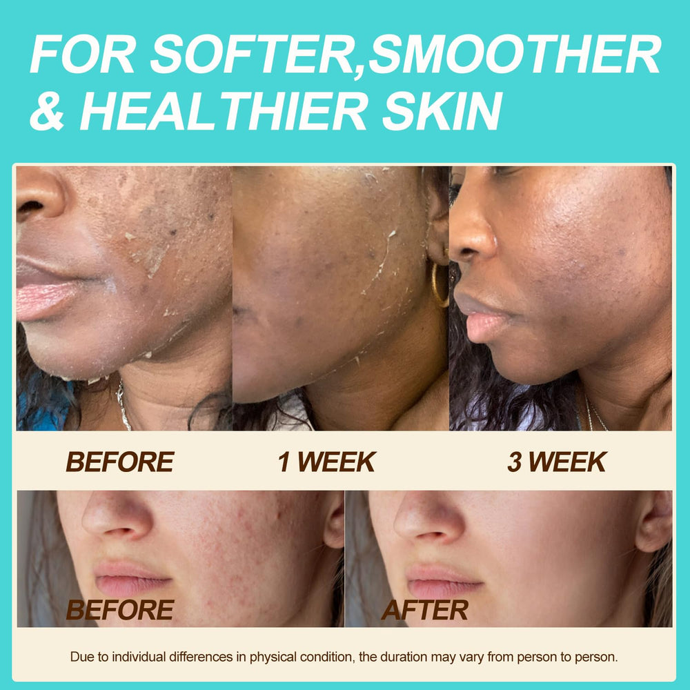 Auteli shea butter and jojoba oil blend nourishing dry skin areas