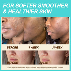 Auteli shea butter and jojoba oil blend nourishing dry skin areas