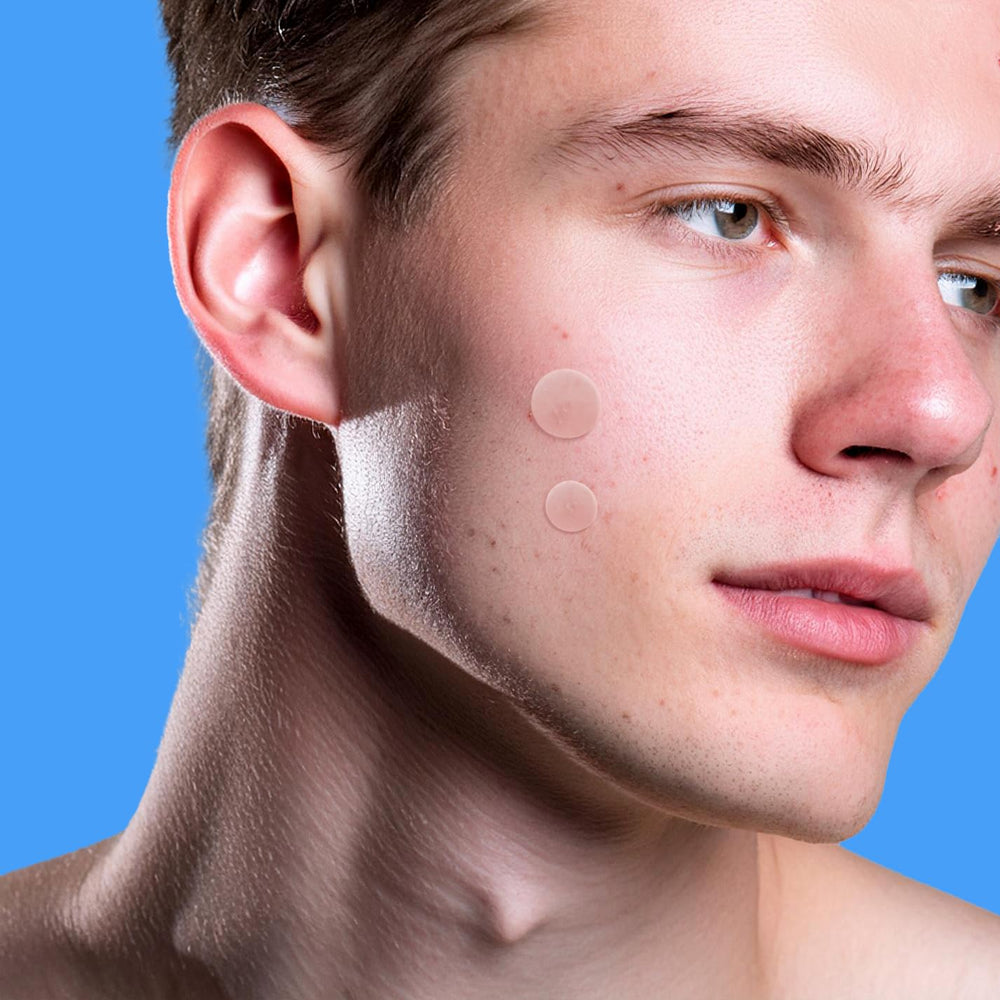 AVARELLE Calendula and Cica patch on blemish for soothing irritated skin and protection.