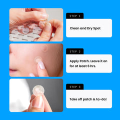 AVARELLE patches on face covering blemish day and night use