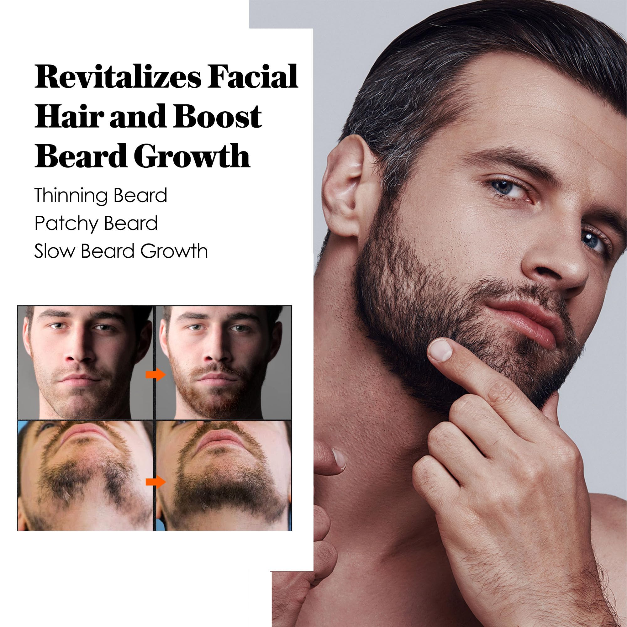 AVITAPURE Minoxidil beard oil application shows nourishing touch and hydration