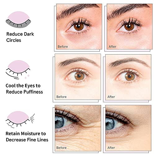 AVJONE collagen eye patches with hyaluronic acid in a pack for refreshed eyes.