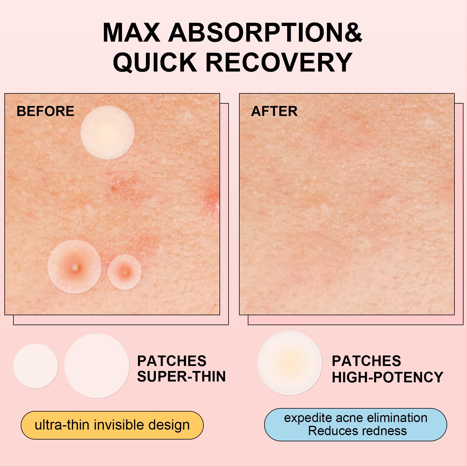 AVJONE nighttime patch on skin provides overnight support with added ingredients.