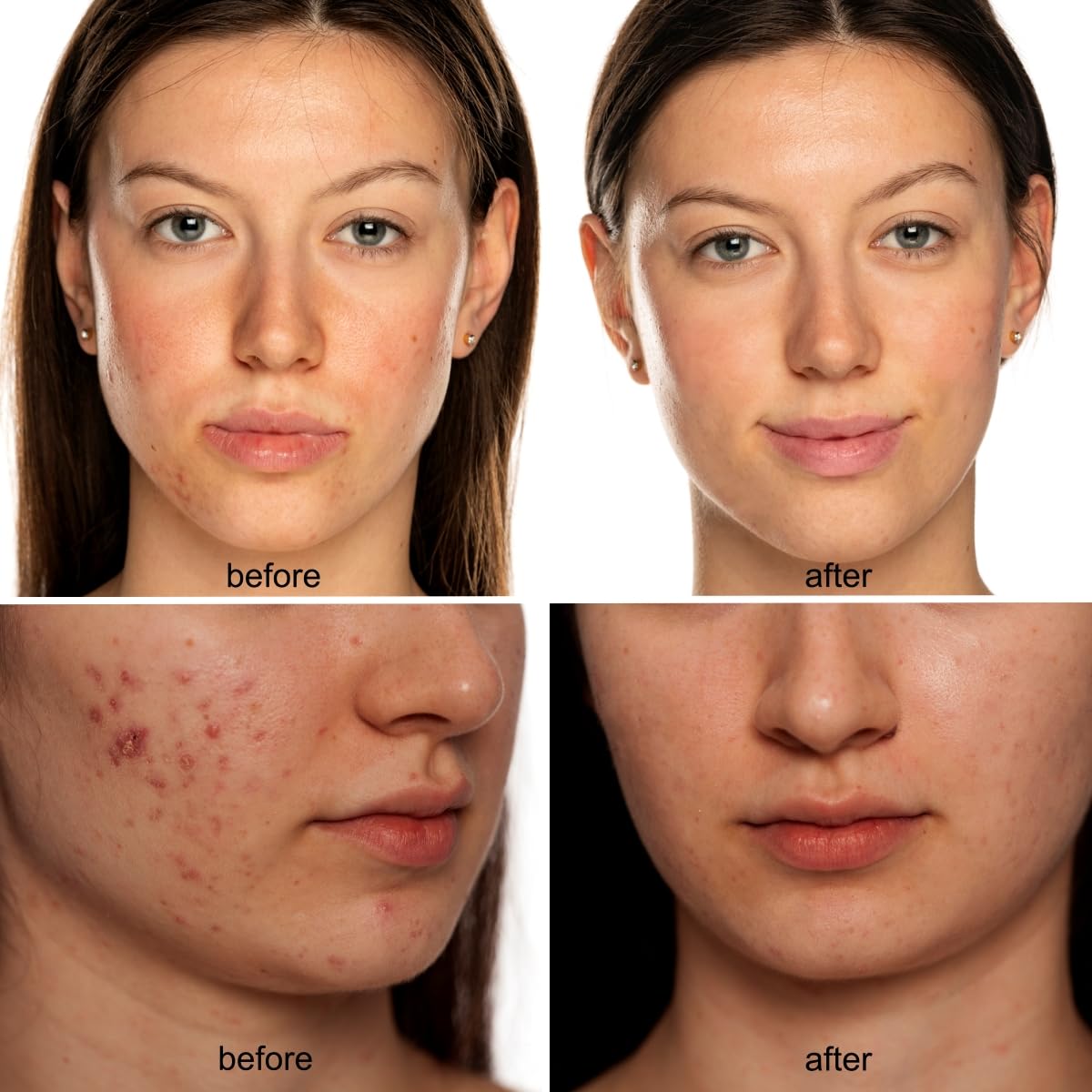 Avorla Beauty LED mask portable, hands-free design for multitasking during treatments.