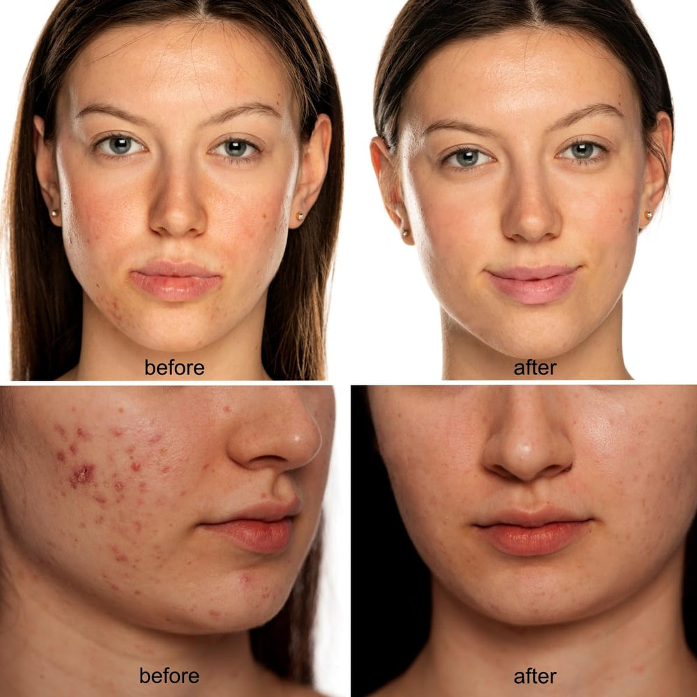 Avorla Beauty LED mask portable, hands-free design for multitasking during treatments.