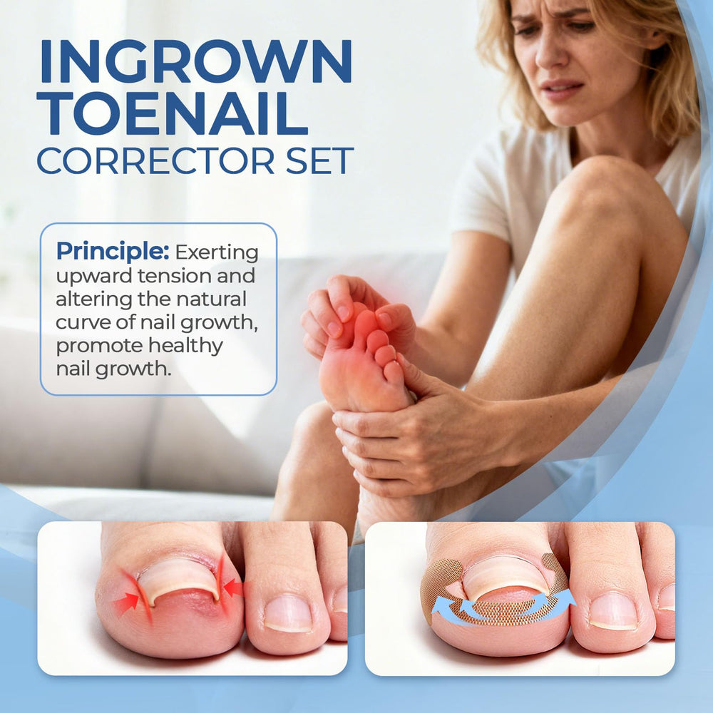 awrose correction patches 50pcs laid out for quick, gentle realignment and comfortable nail growth