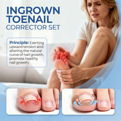 awrose correction patches 50pcs laid out for quick, gentle realignment and comfortable nail growth