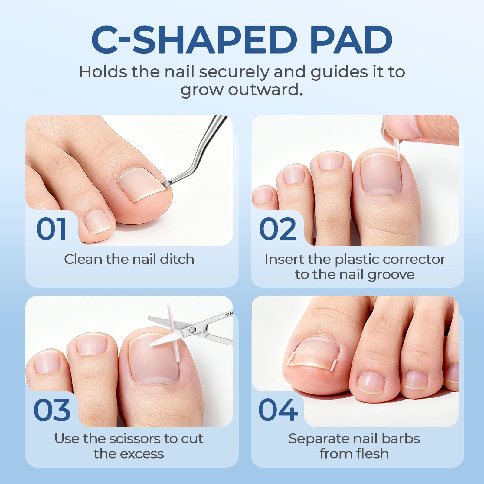 awrose flexible gel correction strips 16pcs designed to fit under the nail edge
