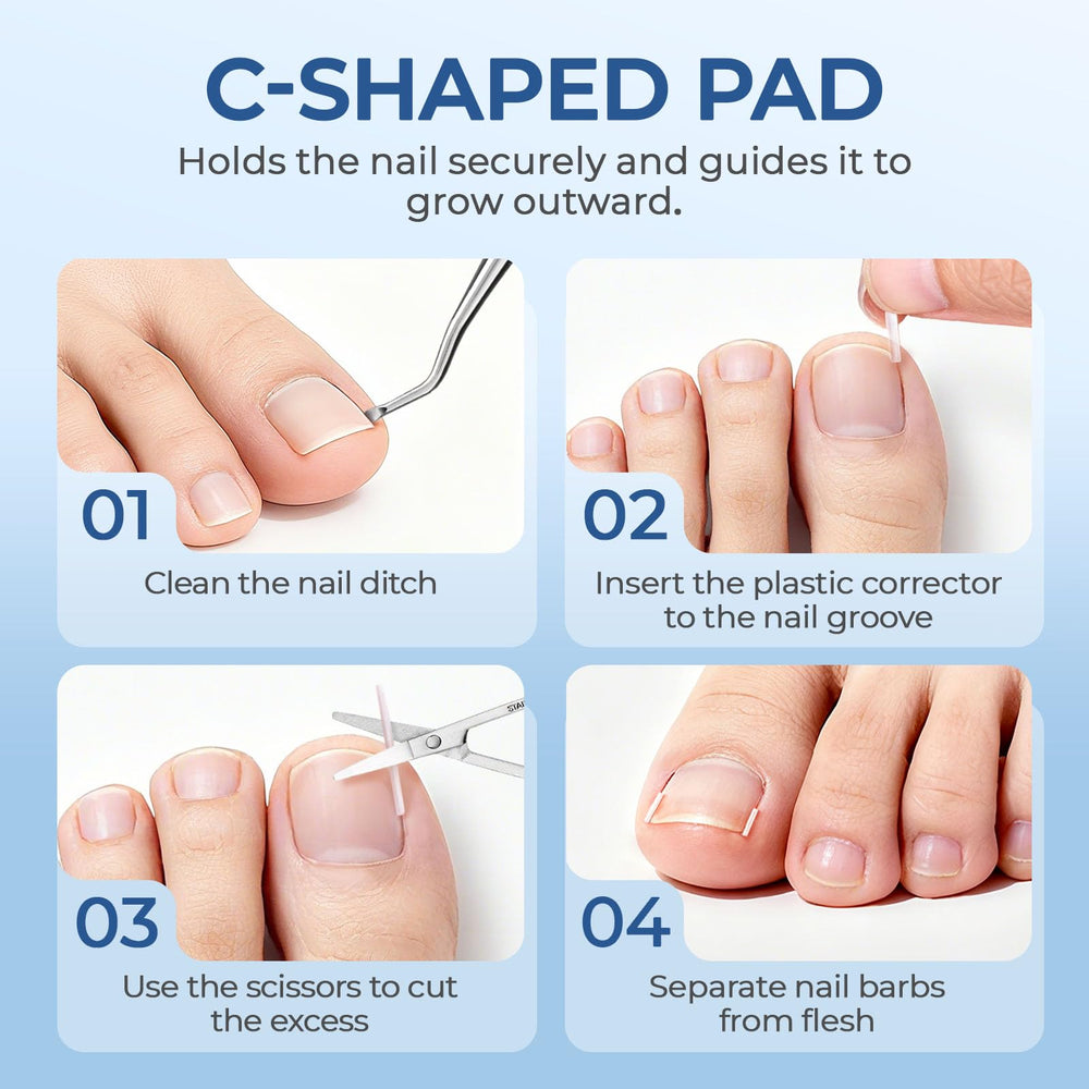 awrose flexible gel correction strips 16pcs designed to fit under the nail edge