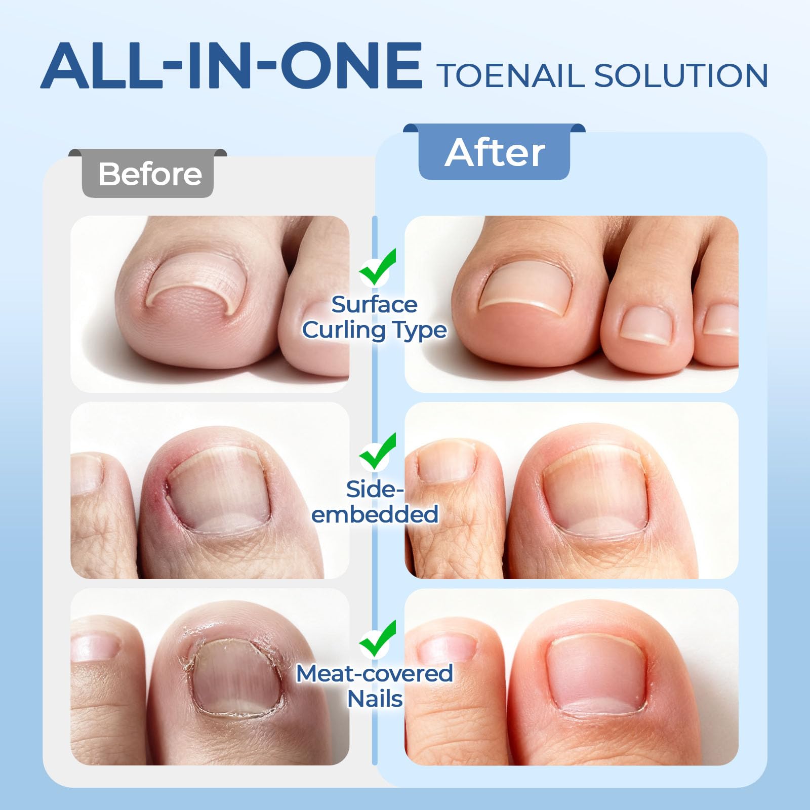 awrose straight and curved cuticle pushers included for precise nail groove cleaning