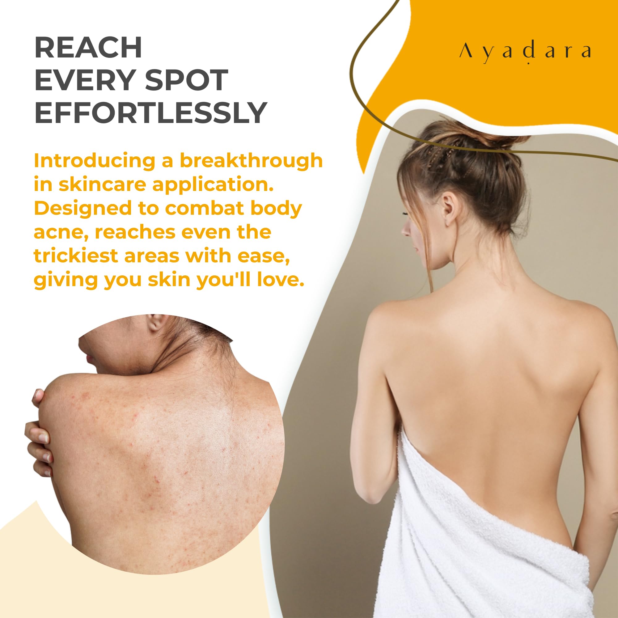AYADARA Acne Body Spray bottle closeup emphasizes quick-drying formula for sensitive skin.