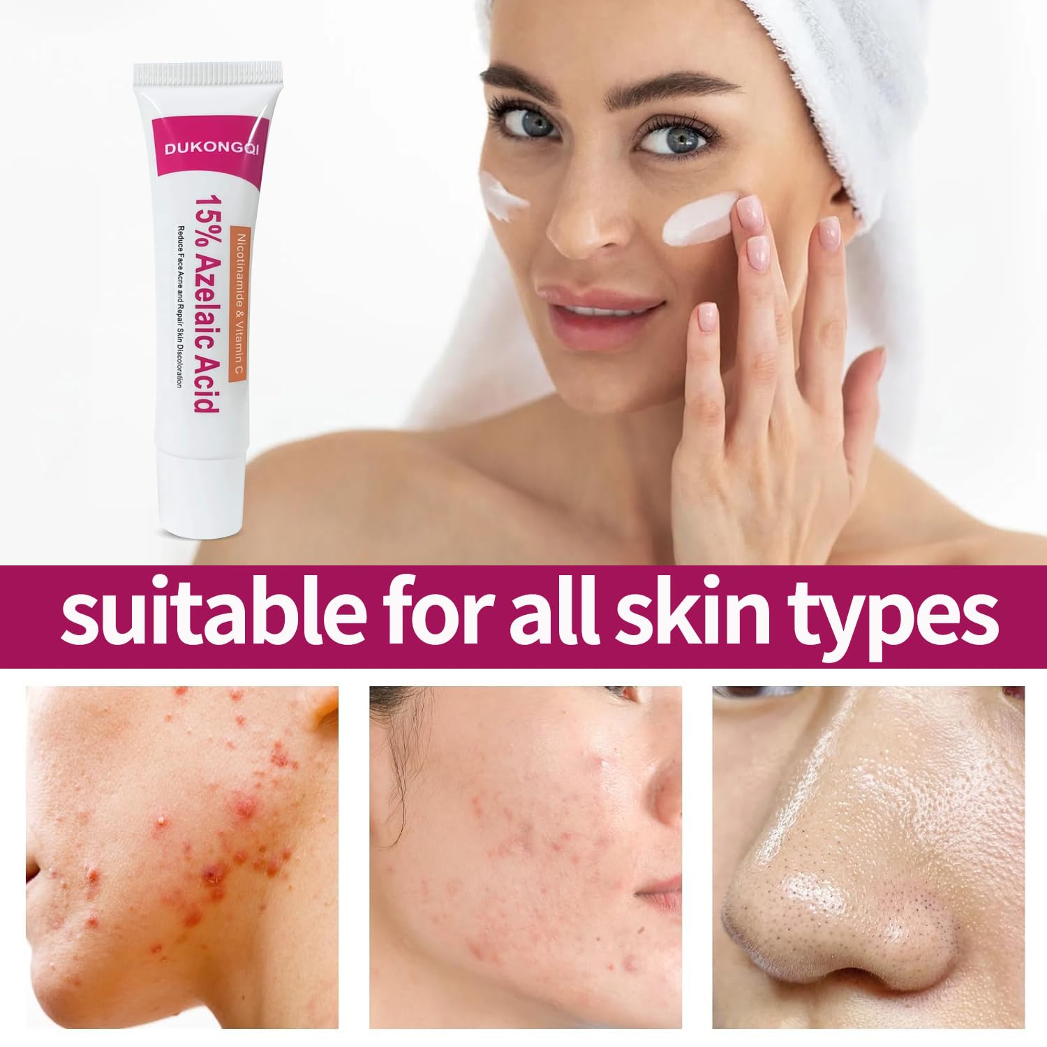 Azelaic Acid Acne Cream application on face demonstrates smooth application for even tone.