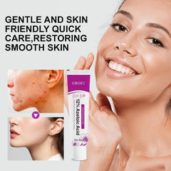 Azelaic Acid Acne Cream pump application enables precise dosing for routine care.