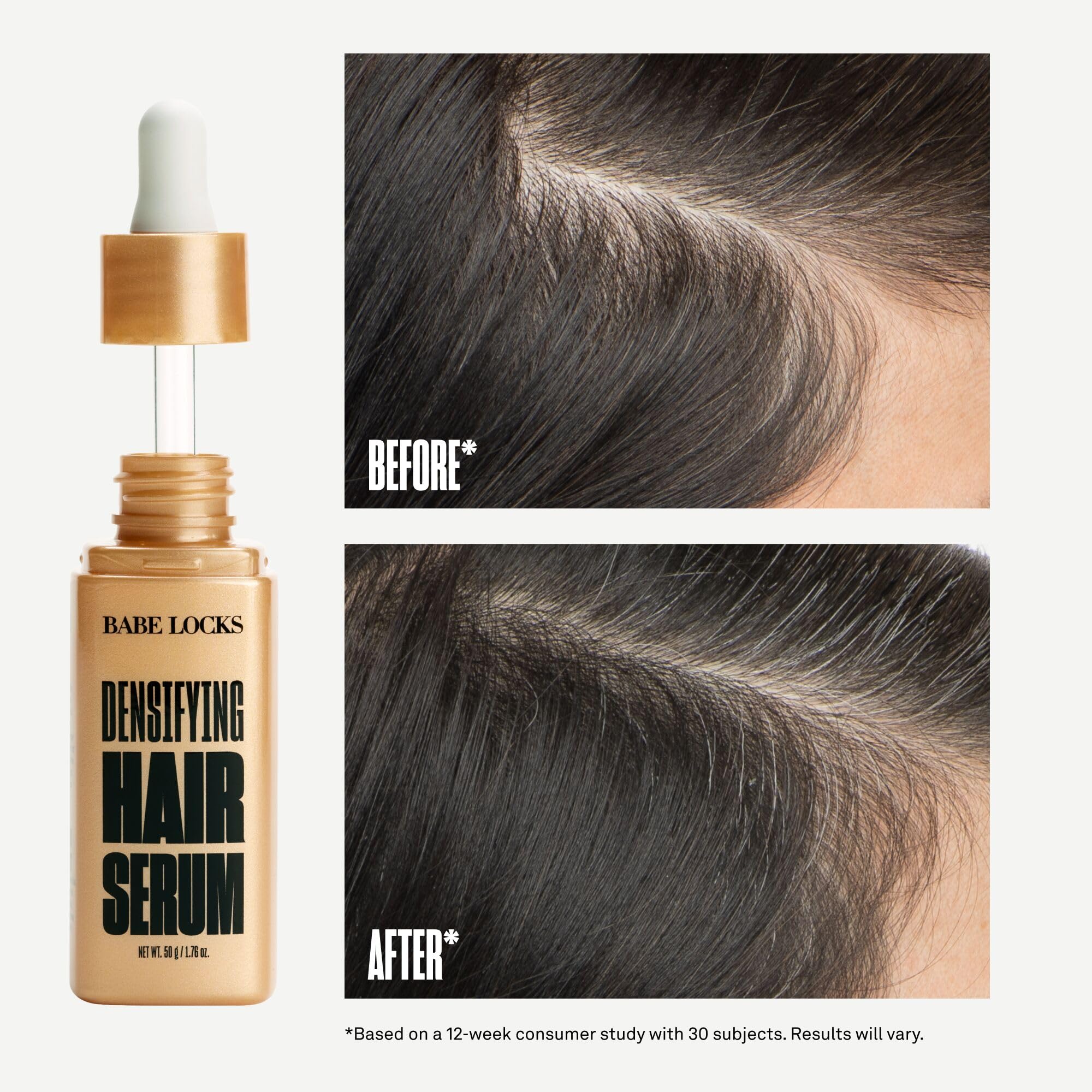 Babe Original Locks Densifying scalp-application demonstrates targeted serum delivery to thinning areas.