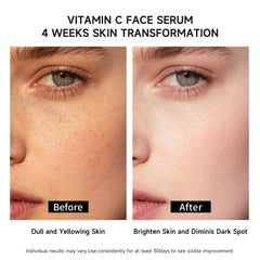 BACHERI vitamin C serum close-up highlights 4D HA for deep hydration.