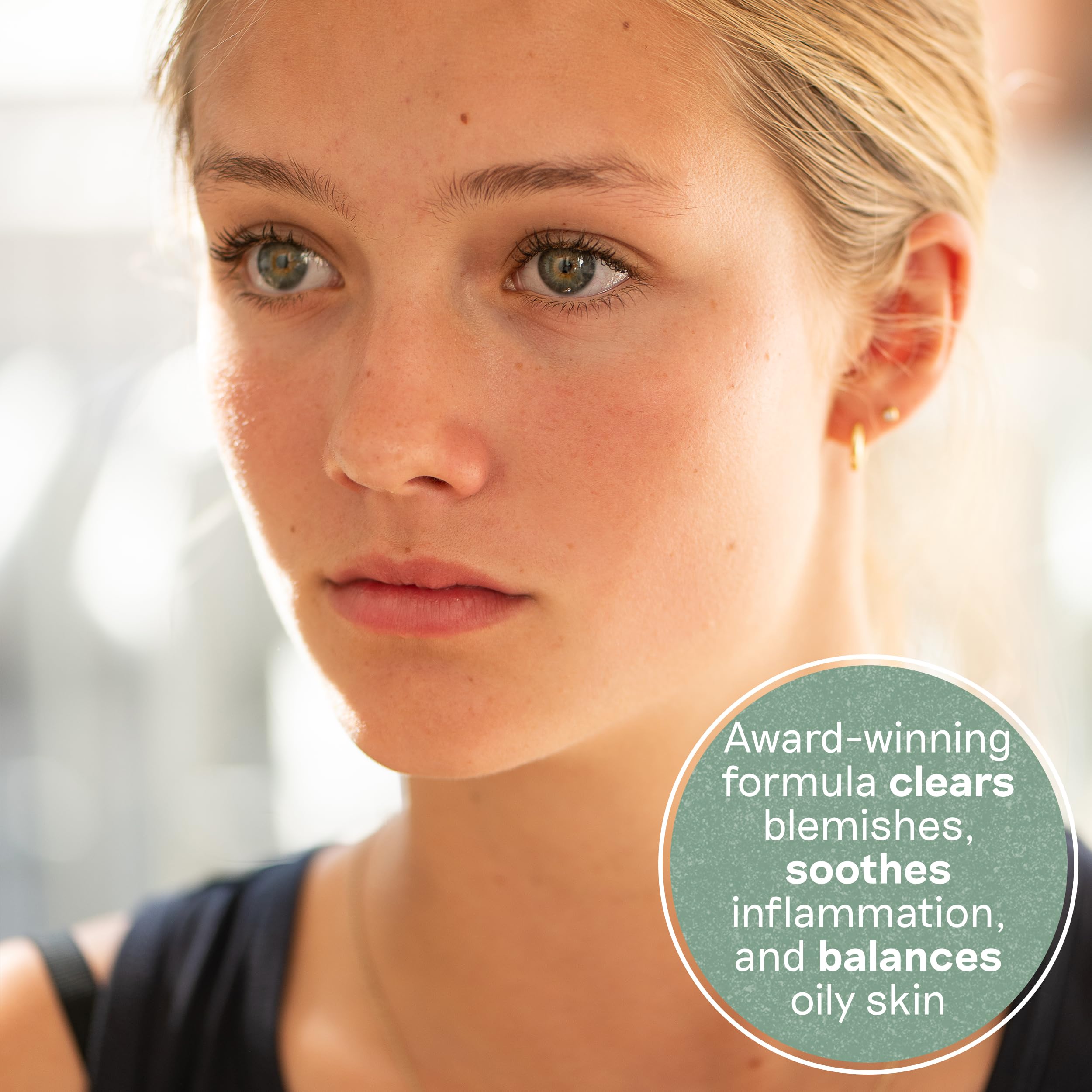 Balance Me Congested Skin Serum texture swatch shows lightweight formula for oily and sensitive skin.