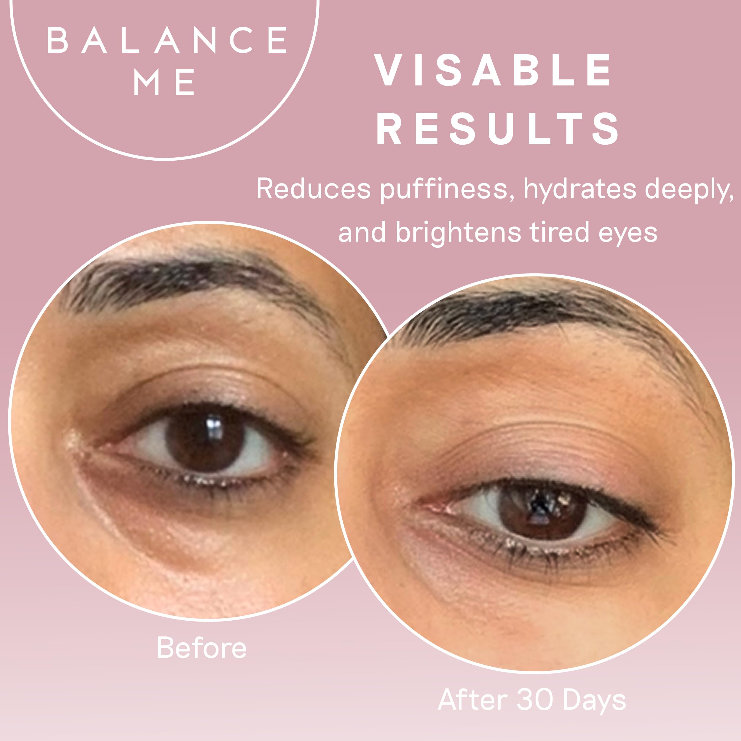 Ingredients like witch hazel and cucumber oil in Balance Me Wonder Eye Cream for soothing care.