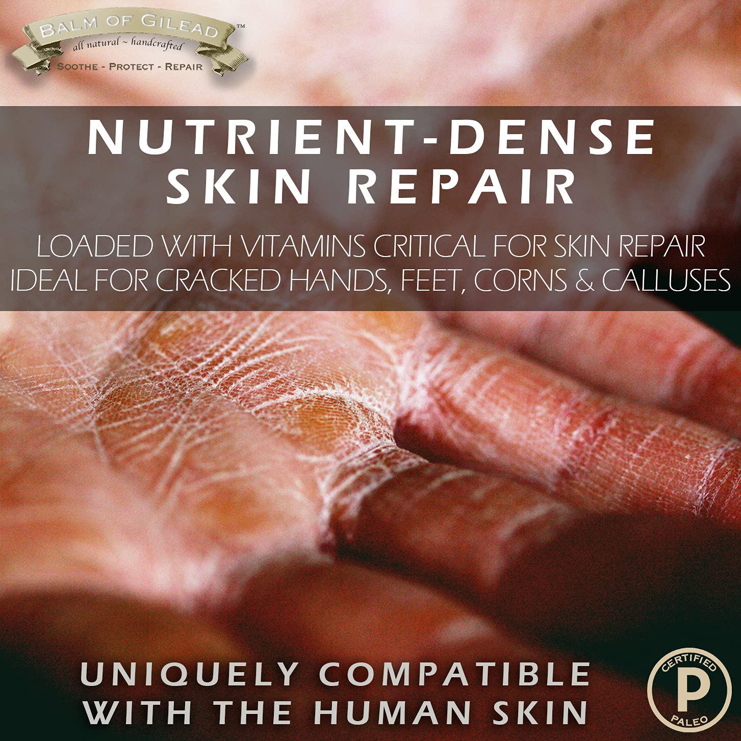 BALM OF GILEAD Dry feet closeup illustrating moisture-sealing formula benefits.