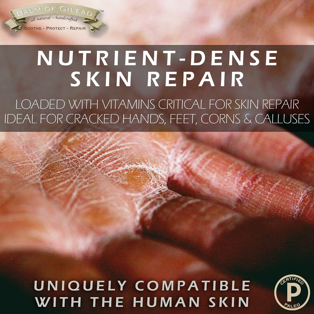 BALM OF GILEAD Dry feet closeup illustrating moisture-sealing formula benefits.