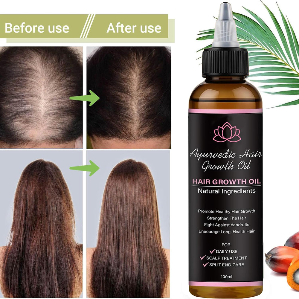 BALPPRD Lifewitqueenp herbal blend features 14 botanicals for balanced scalp