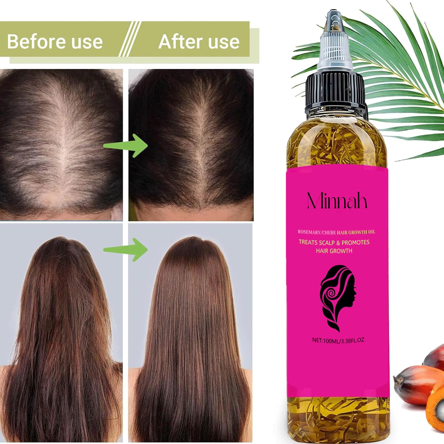 BALPPRD Minnah Batana Oil ready for routine application and care.