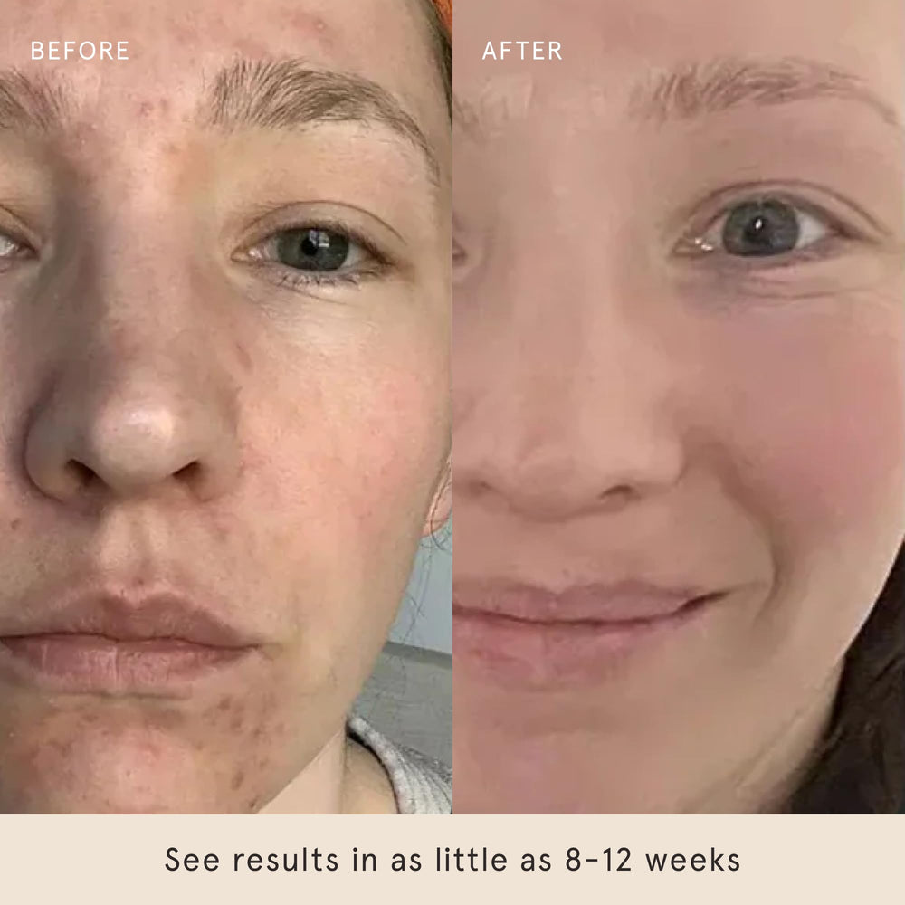 Barefaced Glow Peel Pads packaging 60-count shot highlights value.