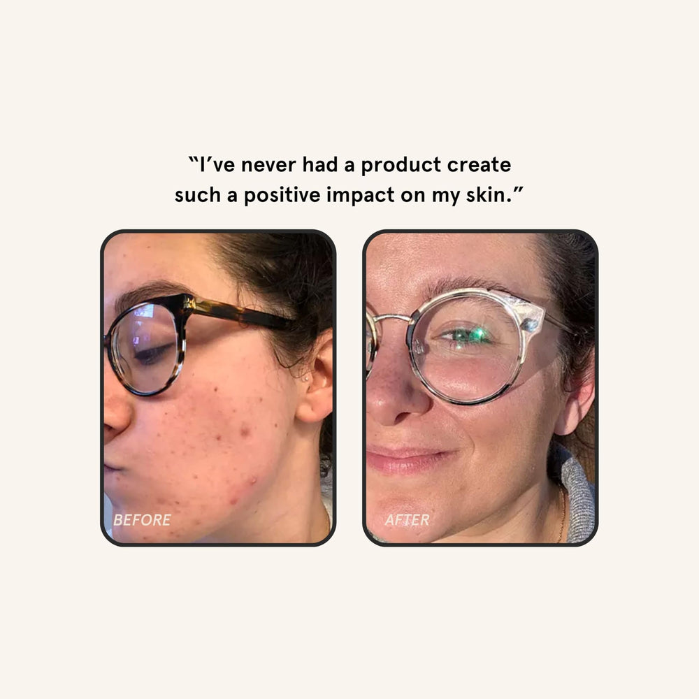 Barefaced Overachiever before-after teaser hints visible improvements over time
