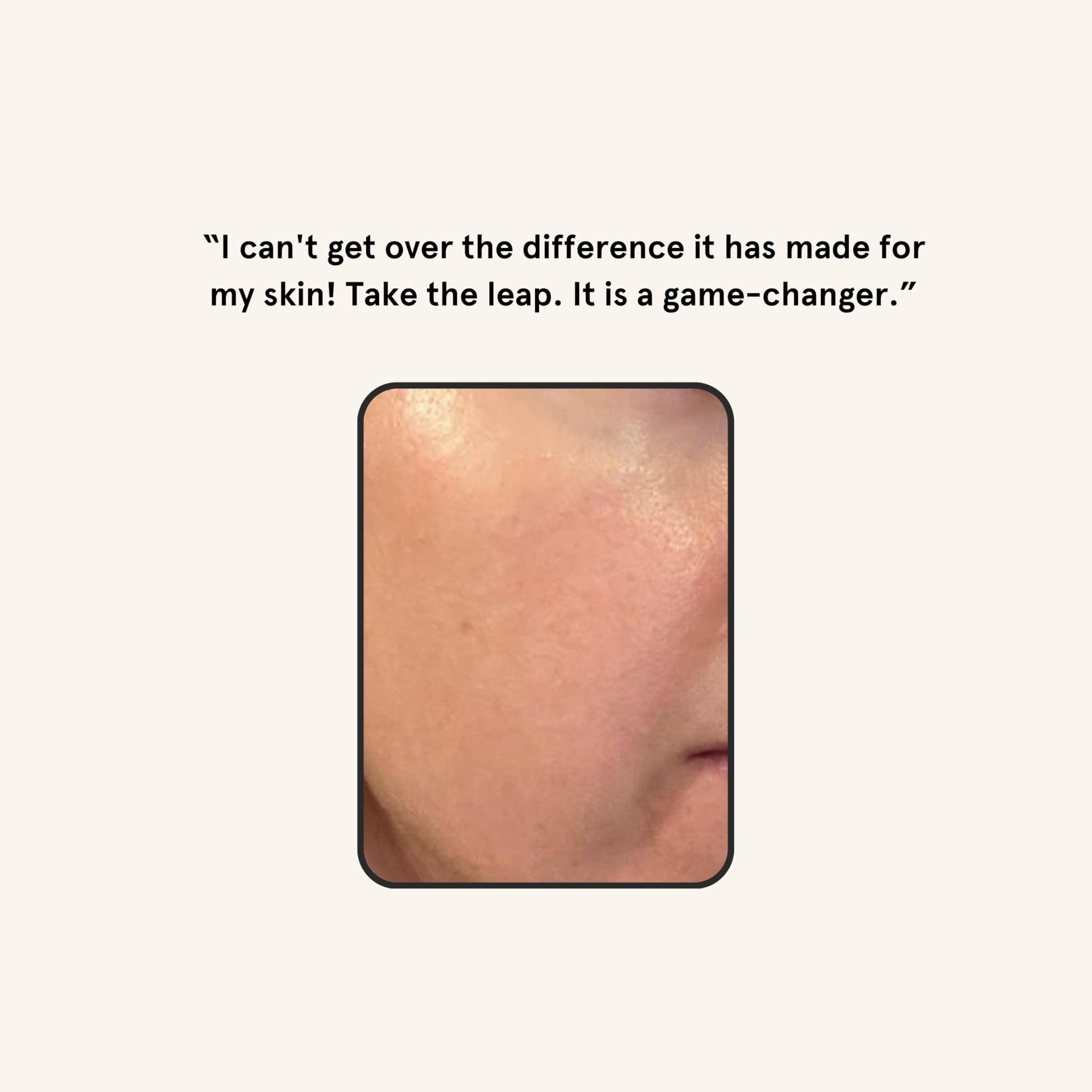 Barefaced skin brightness results show smoother skin after regular dermaplaning