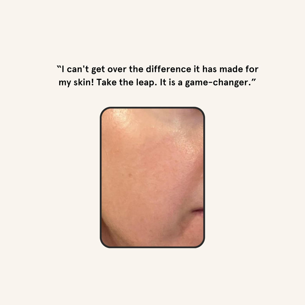 Barefaced skin brightness results show smoother skin after regular dermaplaning
