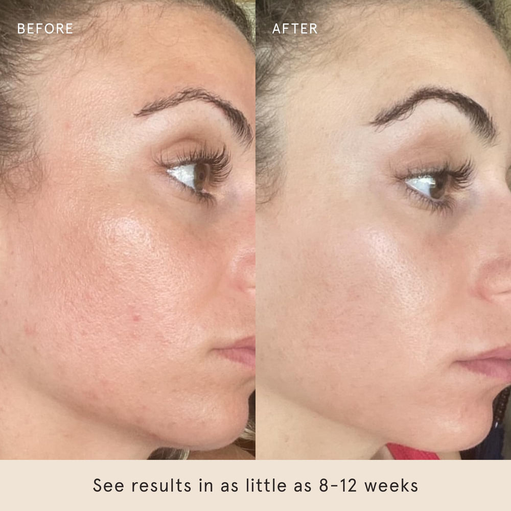 Barefaced Toning Pads open-pack view emphasizing hydrating and calming ingredients