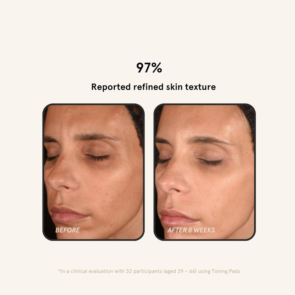 Barefaced Toning Pads pore-refinement-closeup focusing on clearer pores after use