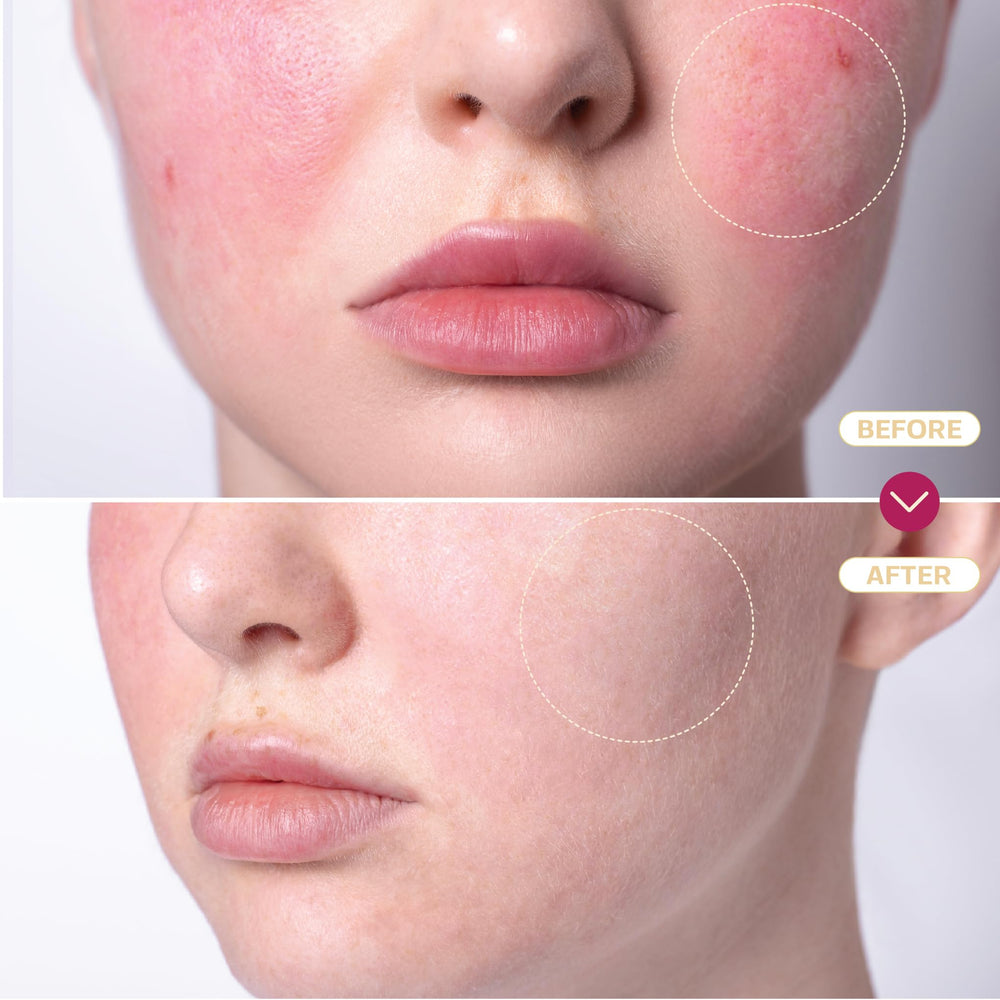 BASE LABORATORIES HOCl spray face-toner-use demonstrates daily cleansing and balance