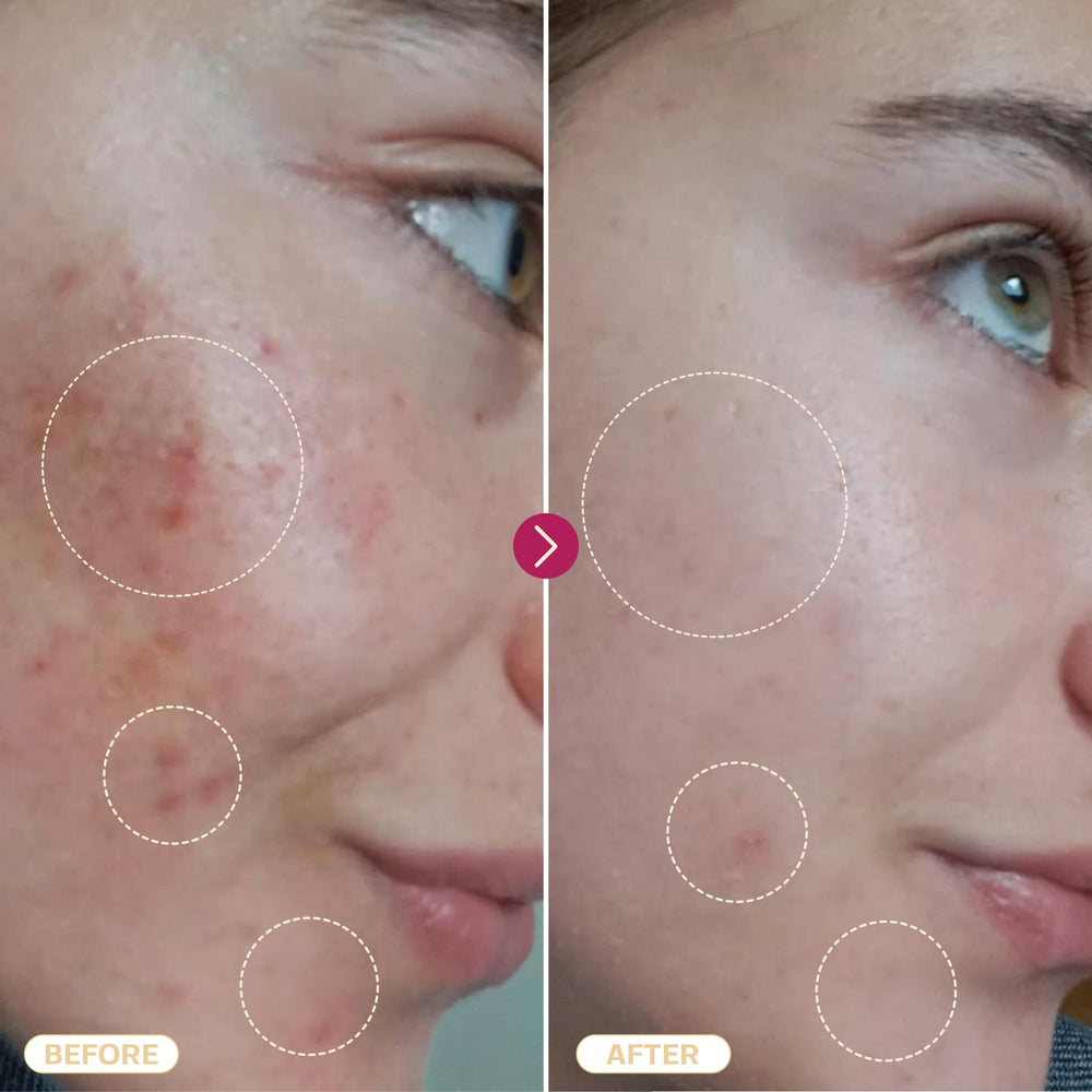 BASE LABORATORIES skin care routine with HOCl for daily cleansing and soothing care