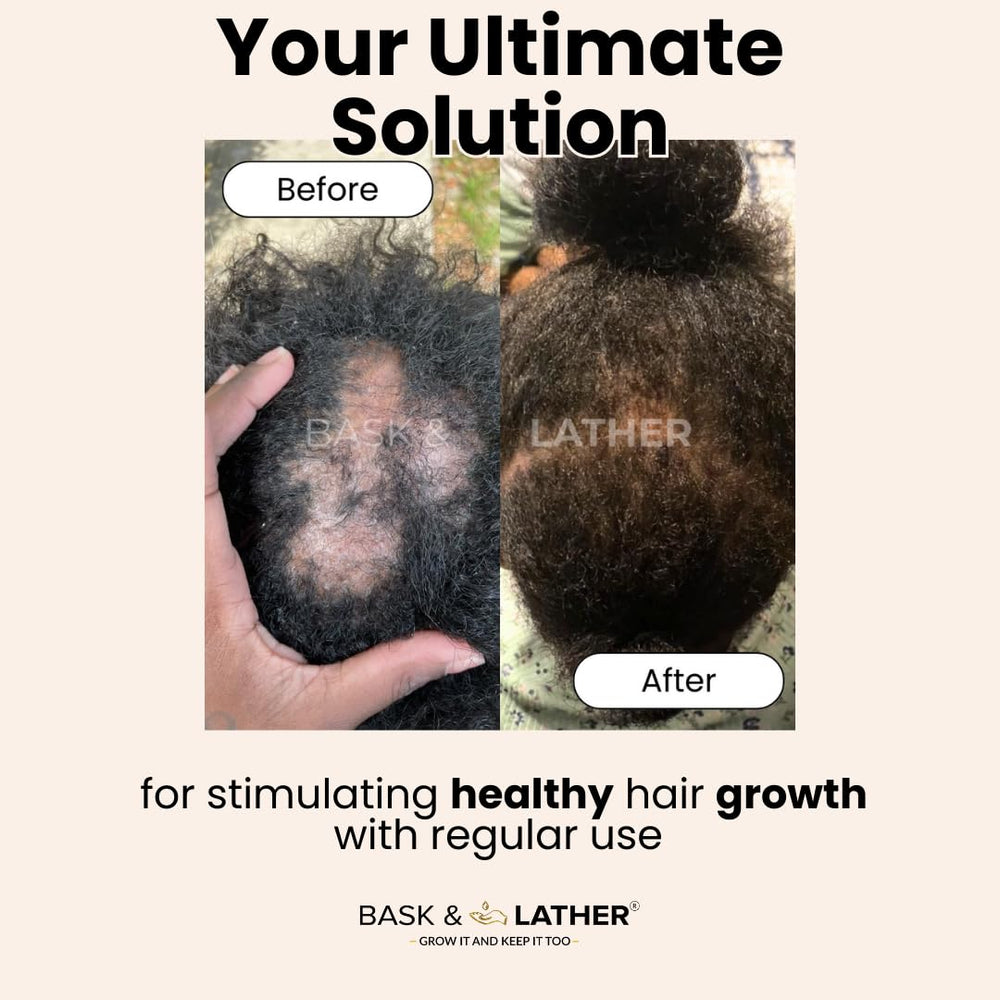 Bask & Lather Scalp Stimulator being applied to the scalp for nourishing use.