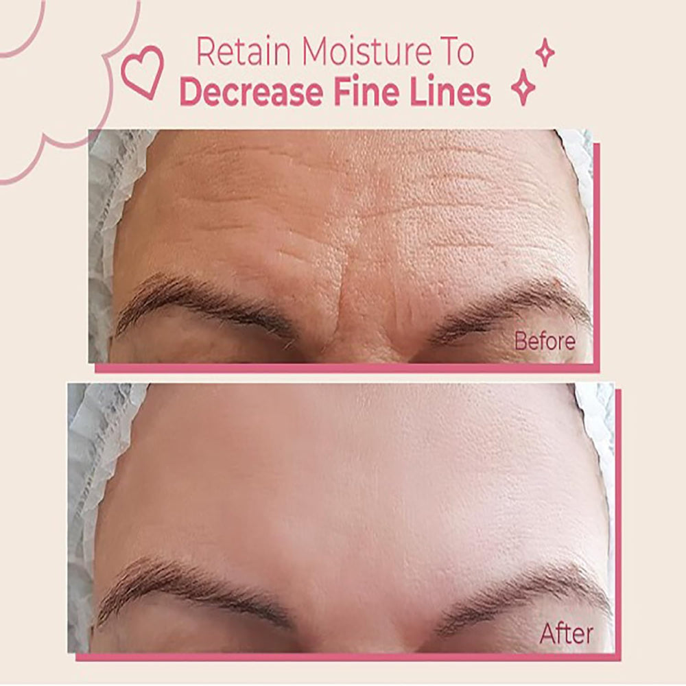 Bayside Forehead Wrinkle Patches closeup showing reusable patches for multiple night use
