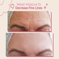 Bayside Forehead Wrinkle Patches closeup showing reusable patches for multiple night use