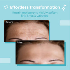 Bayside forehead wrinkle patches on face illustrate smoothing look for daily wear.