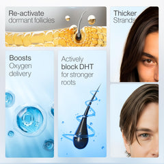 Be Bodywise roll-on applicator close-up for targeted scalp care