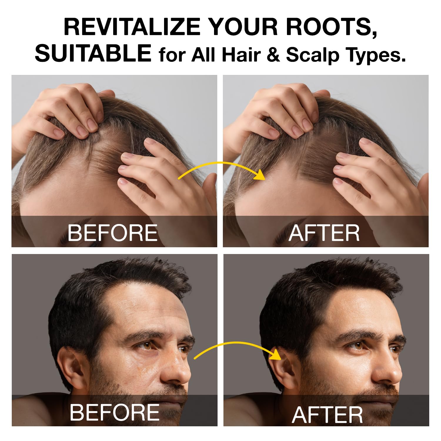 Beadlamey Root Activator Shampoo lather shown for scalp cleansing.