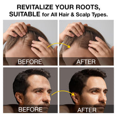 Beadlamey Root Activator Shampoo lather shown for scalp cleansing.