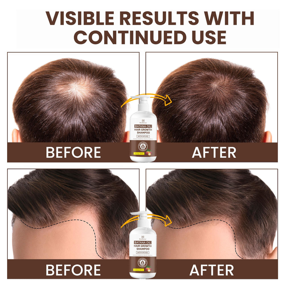 Beadlamey Rosemary, Tea Tree, Peppermint Oils provide soothing scalp care and refreshing cleanse.